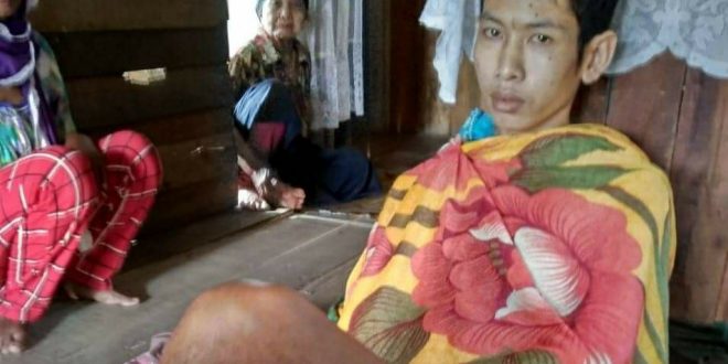 Dinsos Telah Fasilitasi Keluarga Penderita Kanker