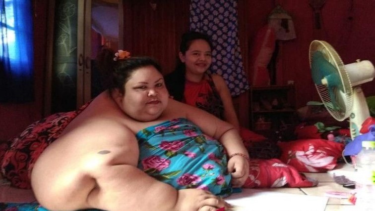 Penanganan Wanita Obesitas yang memiliki berat 350 Kg di Kota Palangka Raya