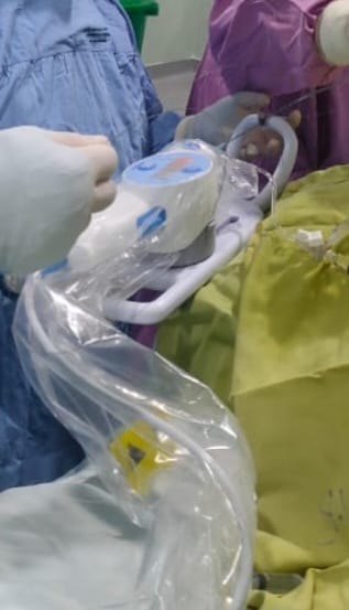 RSUD dr. Doris Sylvanus Telah Lakukan Tindakan Vacular dengan Penggunaan Alat IVUS