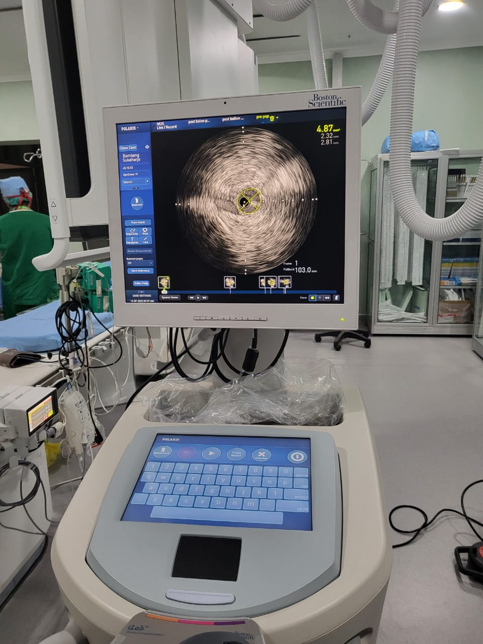 RSUD dr. Doris Sylvanus Telah Lakukan Tindakan Vacular dengan Penggunaan Alat IVUS