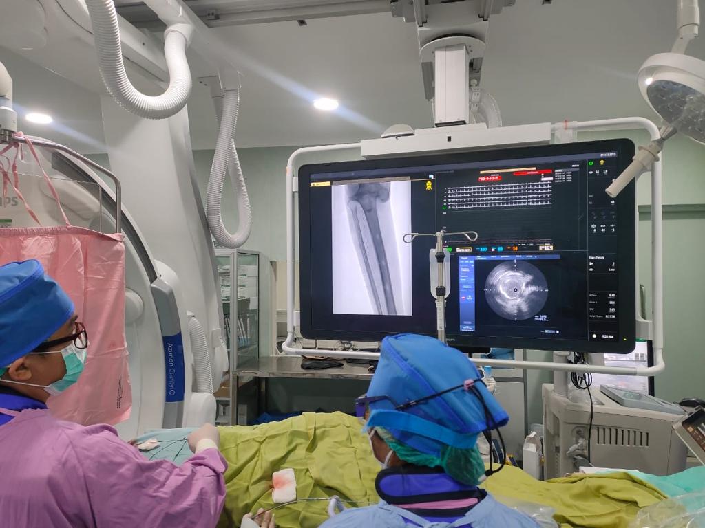 RSUD dr. Doris Sylvanus Telah Lakukan Tindakan Vacular dengan Penggunaan Alat IVUS